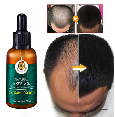 Men And Women Repair Hair Follicles Essential Oil